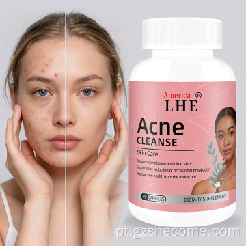 Shecome Acne Capsules Suporte para pele clara